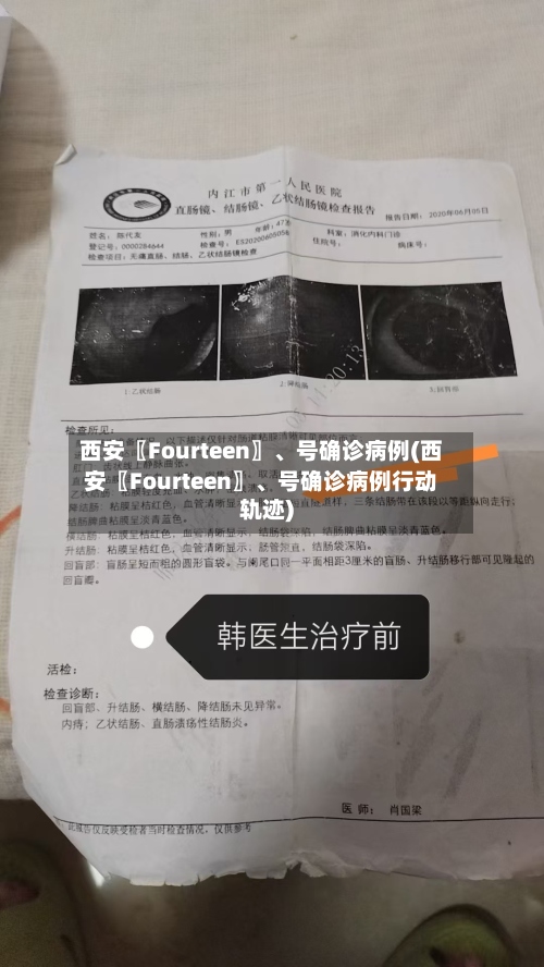 西安〖Fourteen〗	、号确诊病例(西安〖Fourteen〗、号确诊病例行动轨迹)-第3张图片